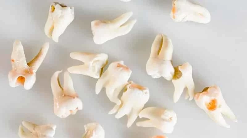 Что значит, если выпадают зубы во сне?