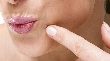 Как избавиться от папиллом с помощью заговоров?